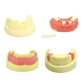 1 шт. зубной имплантат Модель зубов Модель зубов Обучающая модель для изучения зубной имплантат стоматологический инструмент